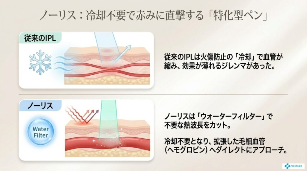 ノーリスの特徴
