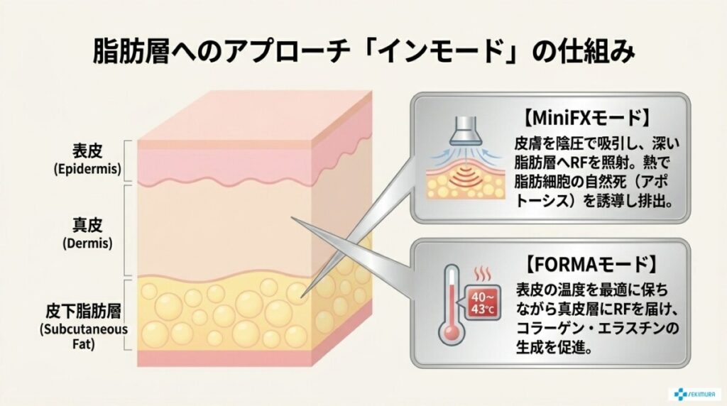 脂肪層へのアプローチなら「インモード」!仕組み・効果と向いている人