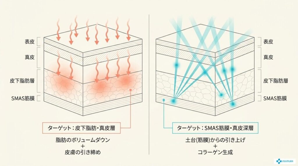 たるみの原因が「脂肪」か「筋膜」かで見極める