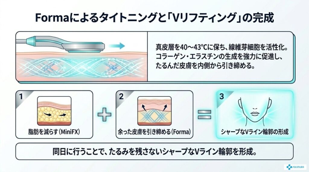 インモードの種類と特徴：MiniFXとForma