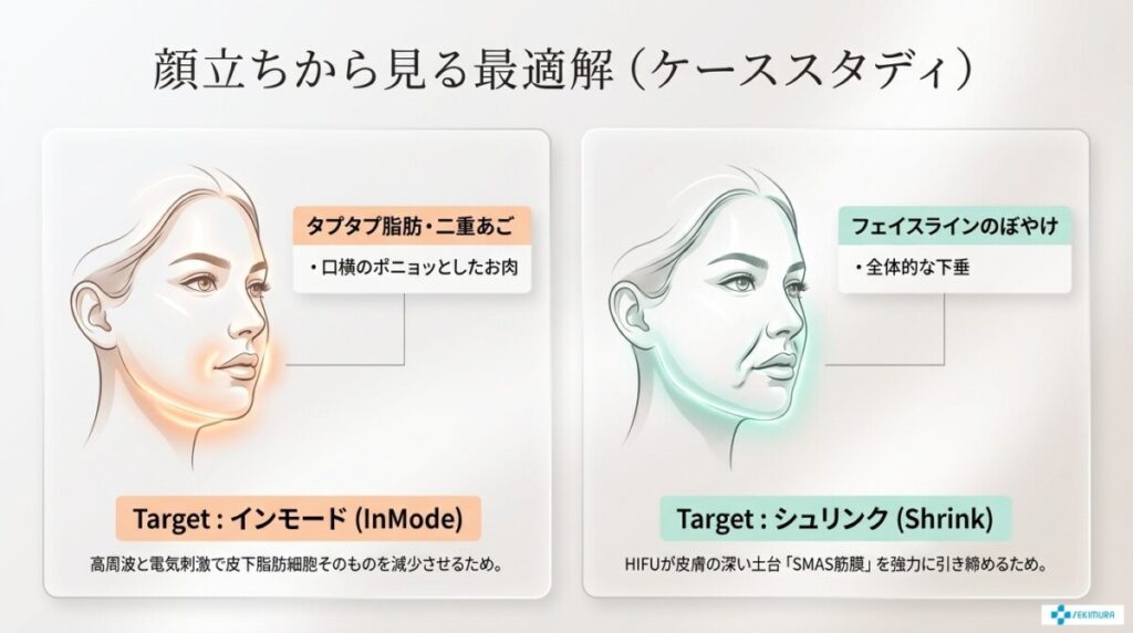 ケーススタディ