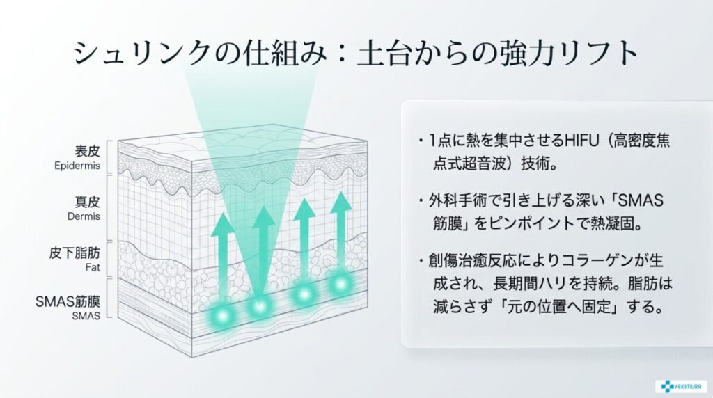 シュリンク（ハイフ）の特徴と仕組み