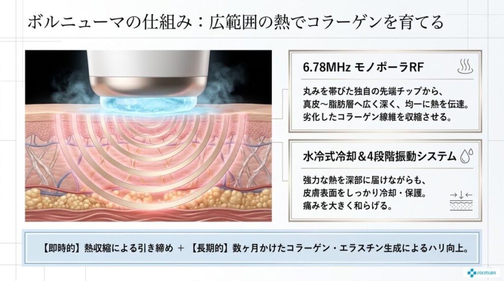 ボルニューマの仕組み：モノポーラ（広範囲の熱）でコラーゲンを育てて引き締め