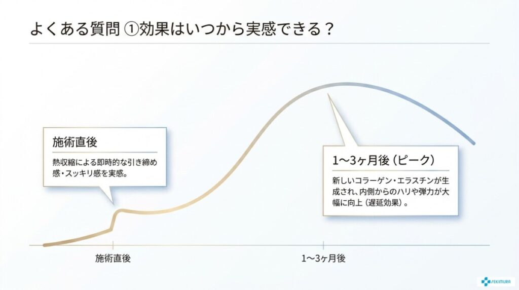 インモードとボルニューマの違いに関するよくある質問（PAA）