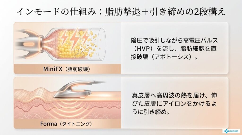 インモード（Vリフティング）の特徴と仕組み