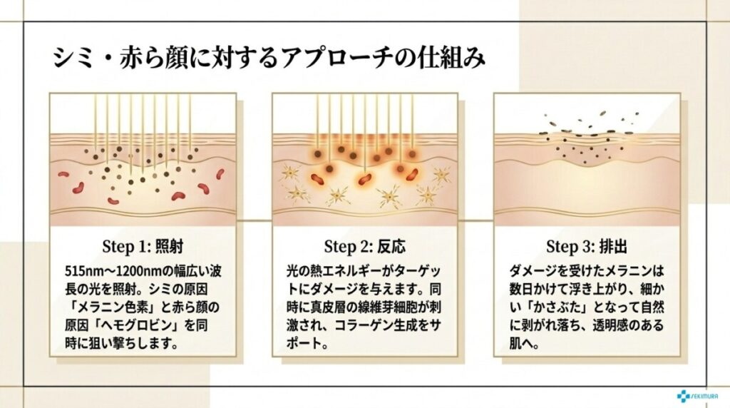 ルメッカ（IPL光治療）のシミ・そばかす・赤ら顔に対するアプローチの仕組みの図解。