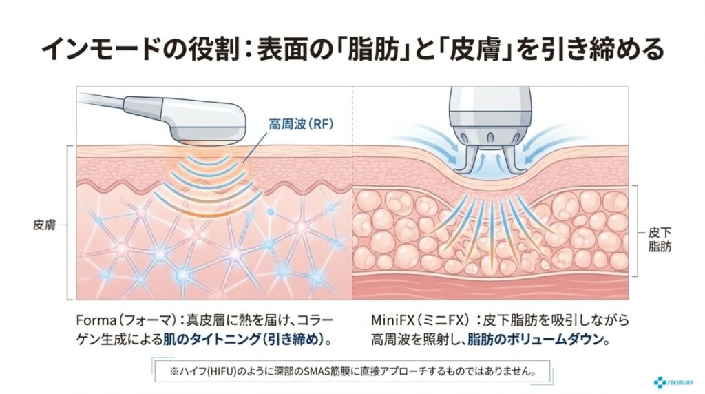 インモードとエラボトックスの相乗効果で最短小顔へ