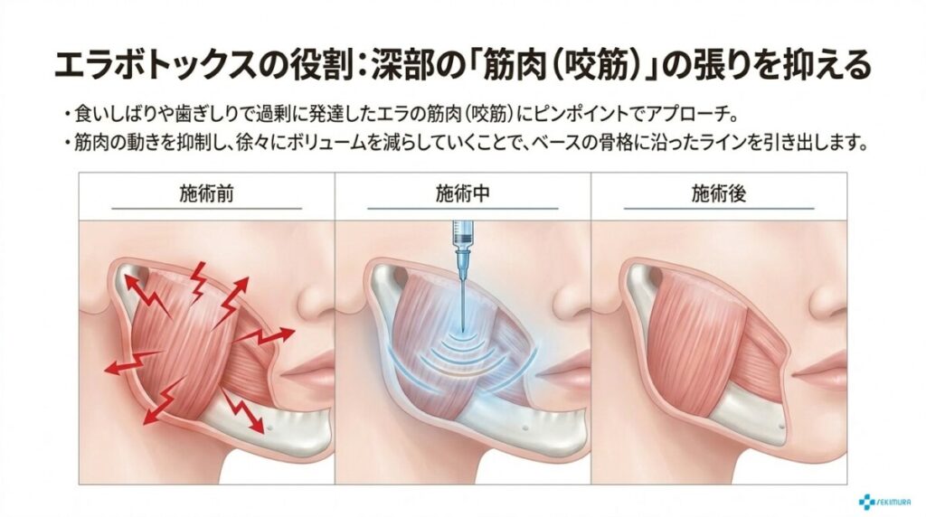 インモードとエラボトックスの相乗効果で最短小顔へ