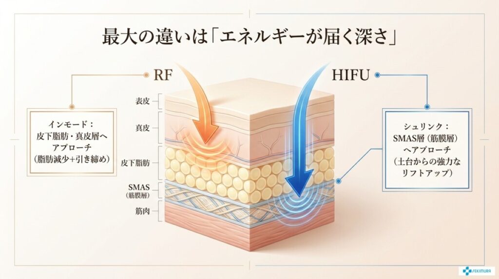 インモードとシュリンクの効果はどう違う?徹底比較