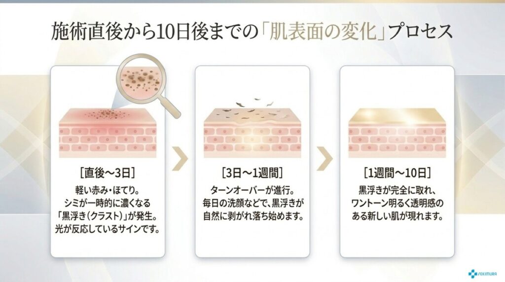 ステラM22の施術直後から10日後までの肌表面の変化プロセスを解説した図解。