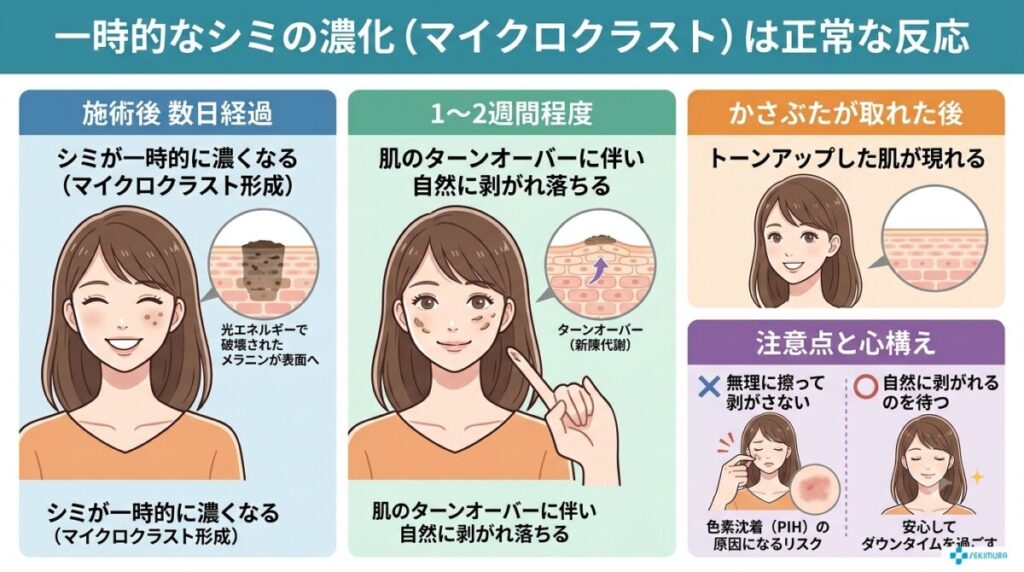 「一時的なシミの濃化（マイクロクラスト）は正常な反応」の図解画像