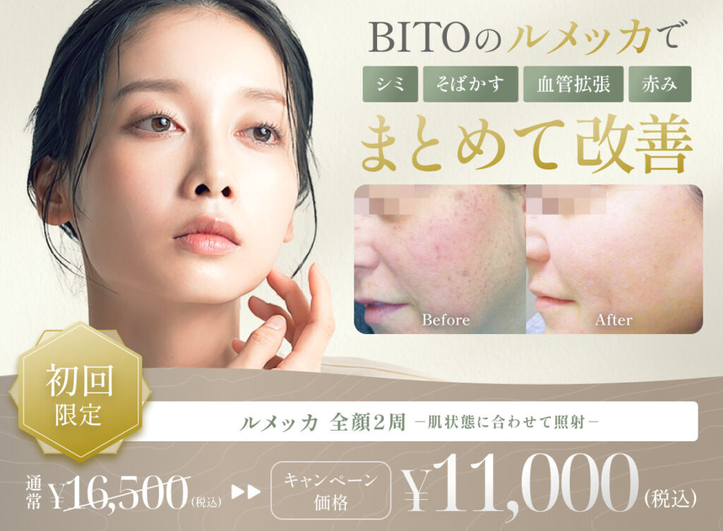 BITO BEAUTY CLINIC ルメッカ