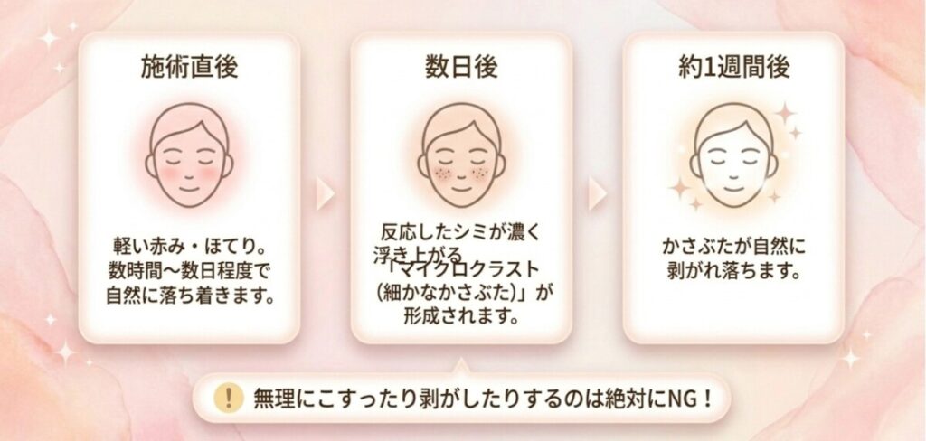ルメッカの基本知識と効果（InMode社製）